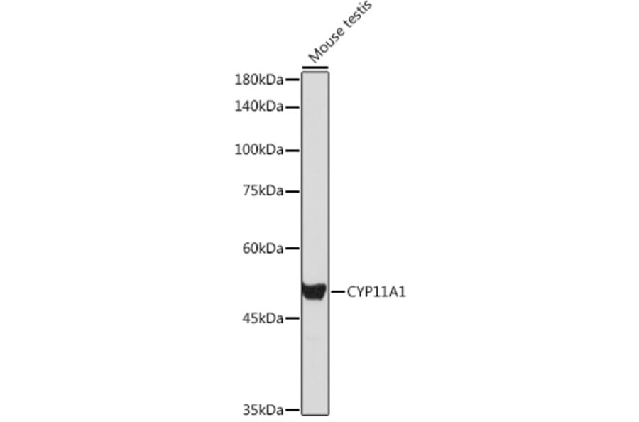 Western Blot - Anti-CYP11A1 Antibody (A90201) - Antibodies.com