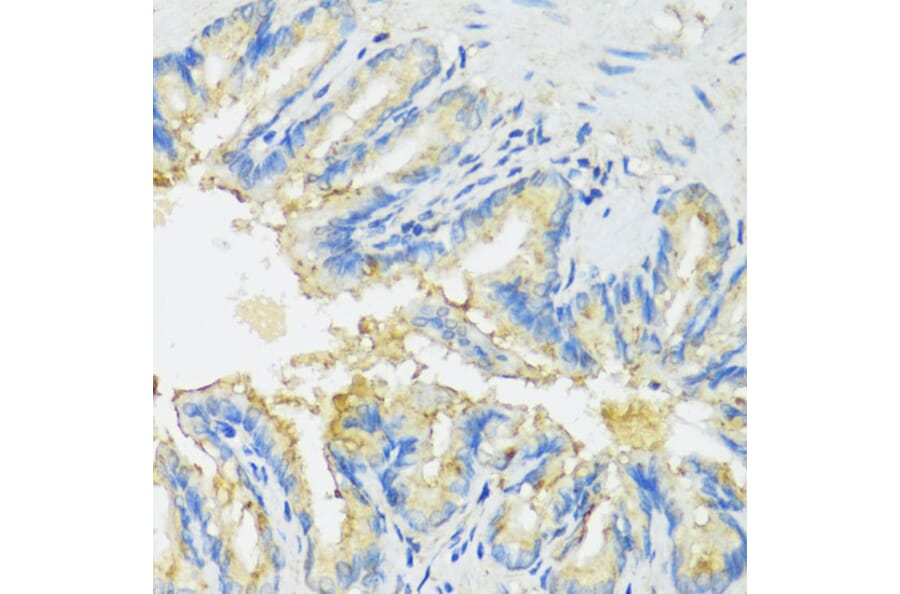 Immunohistochemistry - Anti-CYP11A1 Antibody (A90201) - Antibodies.com