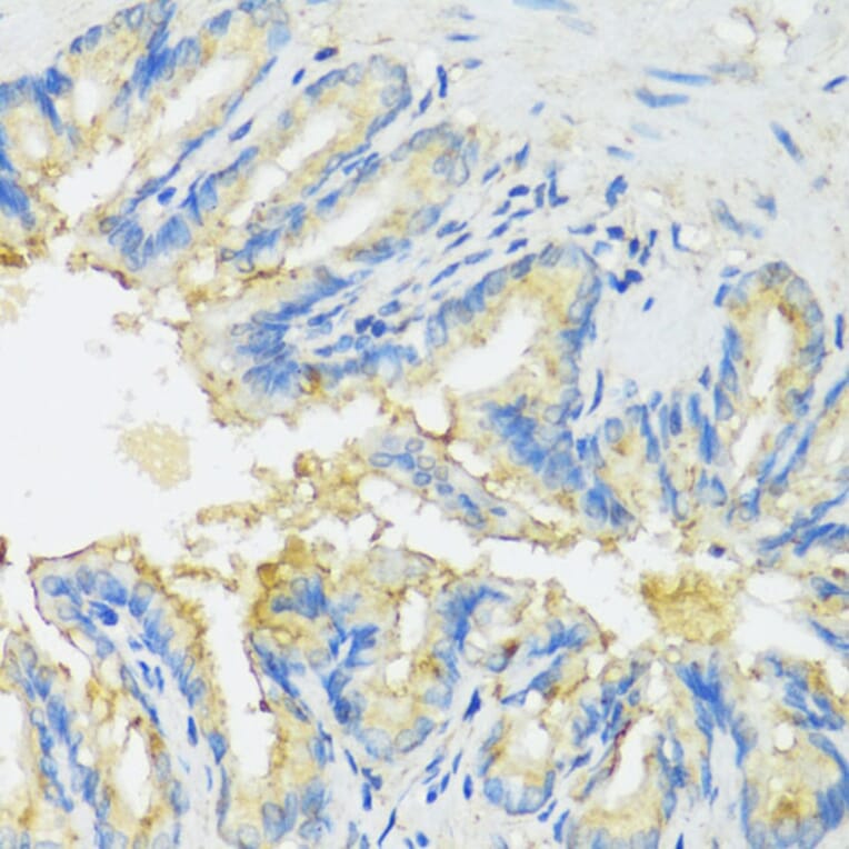 Immunohistochemistry - Anti-CYP11A1 Antibody (A90201) - Antibodies.com