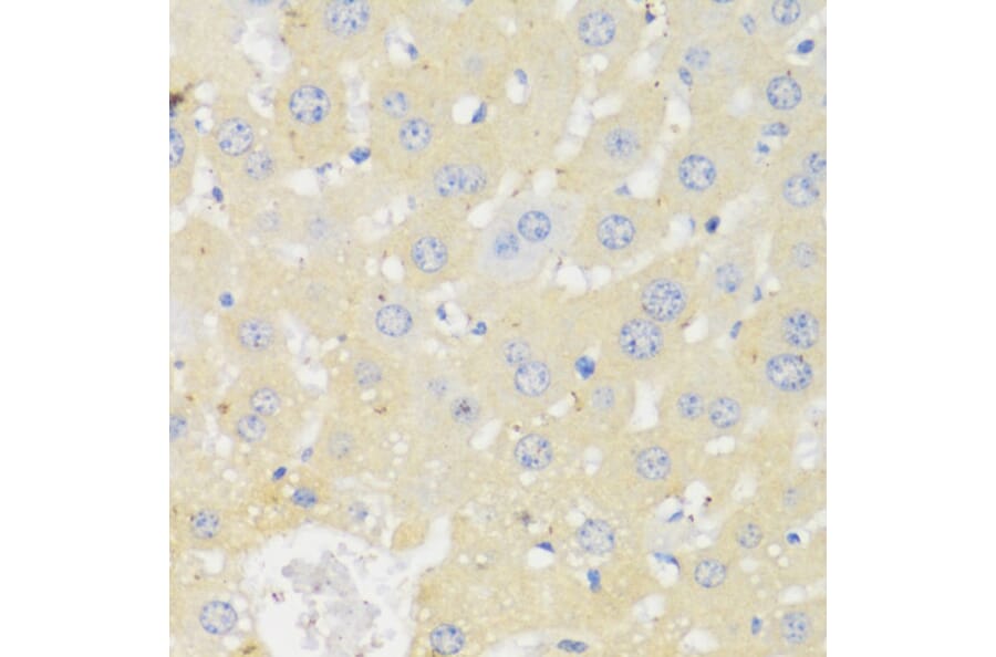 Immunohistochemistry - Anti-CYP11A1 Antibody (A90201) - Antibodies.com