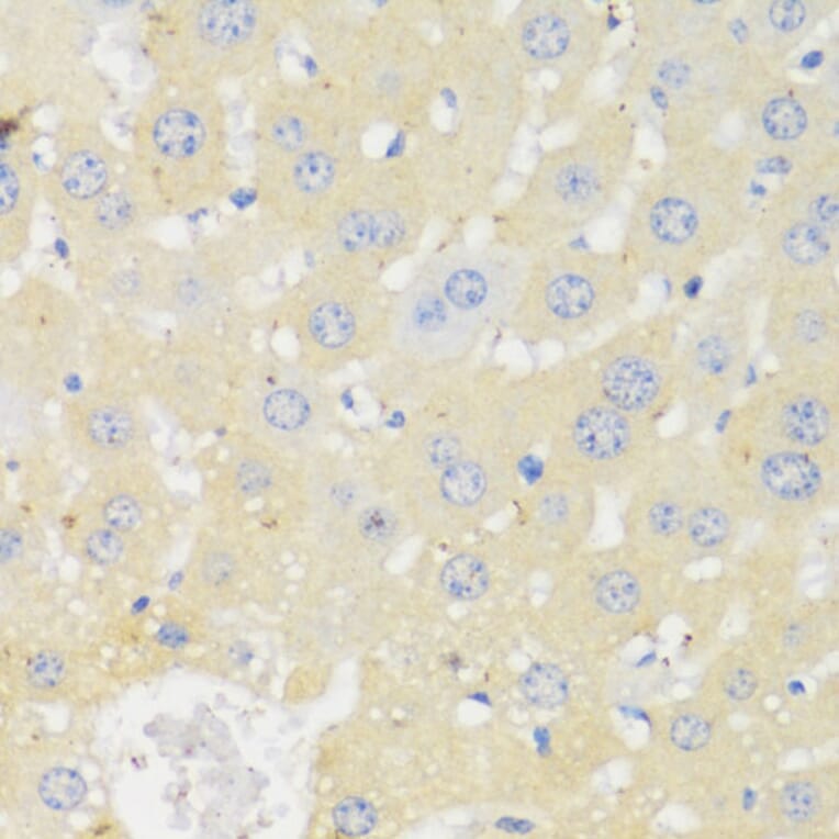 Immunohistochemistry - Anti-CYP11A1 Antibody (A90201) - Antibodies.com