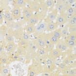 Immunohistochemistry - Anti-CYP11A1 Antibody (A90201) - Antibodies.com