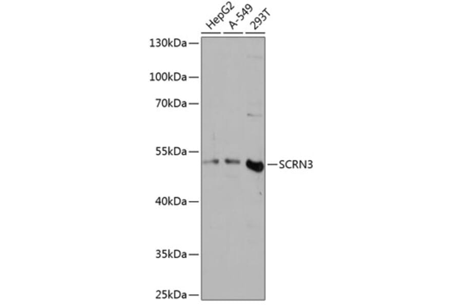 Western Blot - Anti-SCRN3 Antibody (A90202) - Antibodies.com