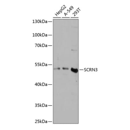 Western Blot - Anti-SCRN3 Antibody (A90202) - Antibodies.com