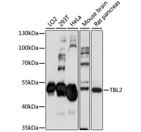 Western Blot - Anti-TBL2 Antibody (A90203) - Antibodies.com
