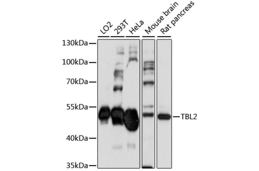 Western Blot - Anti-TBL2 Antibody (A90203) - Antibodies.com