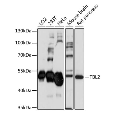 Western Blot - Anti-TBL2 Antibody (A90203) - Antibodies.com