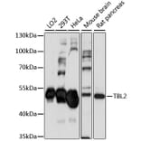 Western Blot - Anti-TBL2 Antibody (A90203) - Antibodies.com