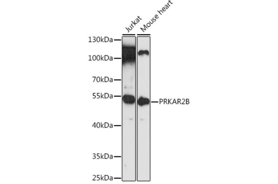 Western Blot - Anti-PRKAR2B Antibody (A12751) - Antibodies.com