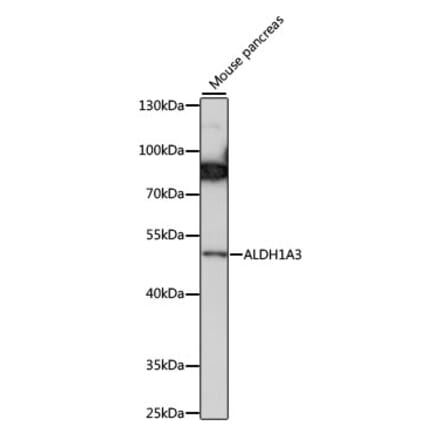 Western Blot - Anti-ALDH1A3 Antibody (A90205) - Antibodies.com