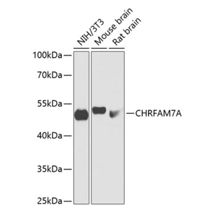 Western Blot - Anti-D-10 Antibody (A90206) - Antibodies.com