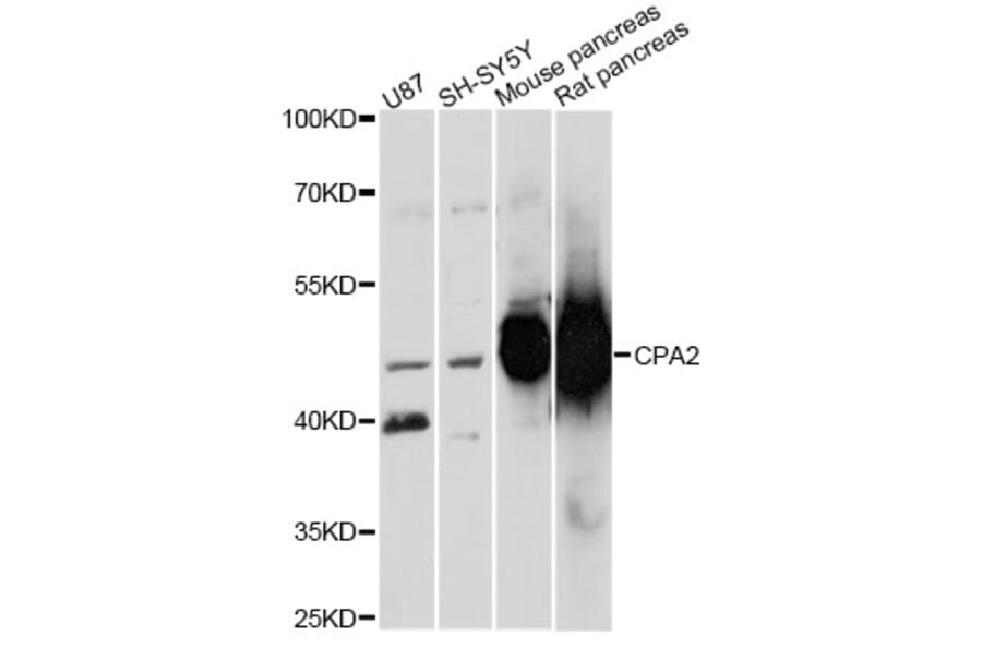 Western Blot - Anti-CPA2 Antibody (A14373) - Antibodies.com