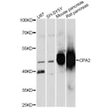 Western Blot - Anti-CPA2 Antibody (A14373) - Antibodies.com