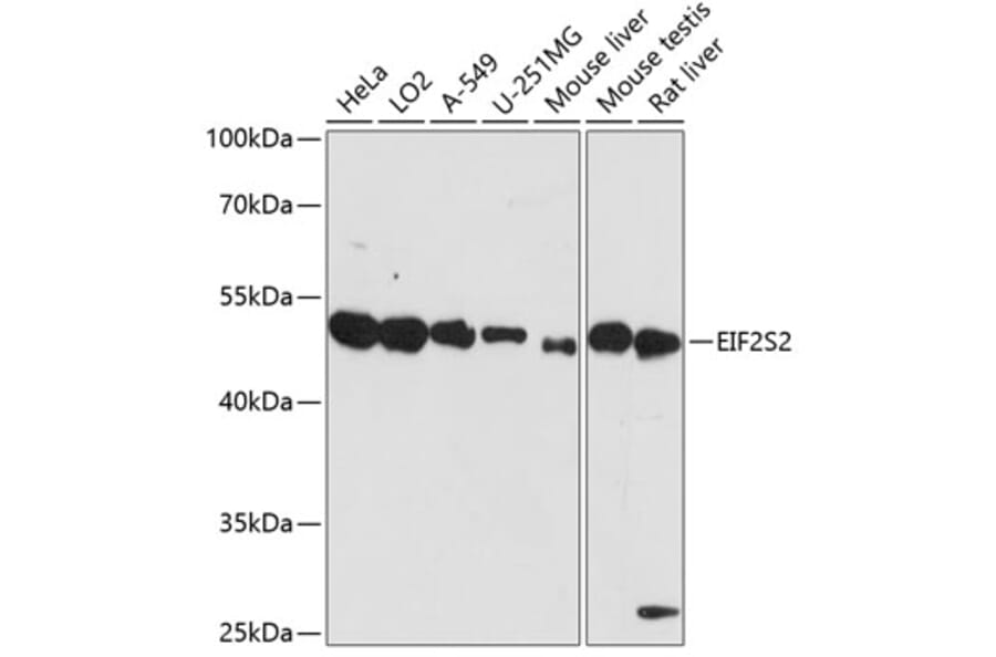 Western Blot - Anti-EIF2S2 / EIF2B Antibody (A90208) - Antibodies.com