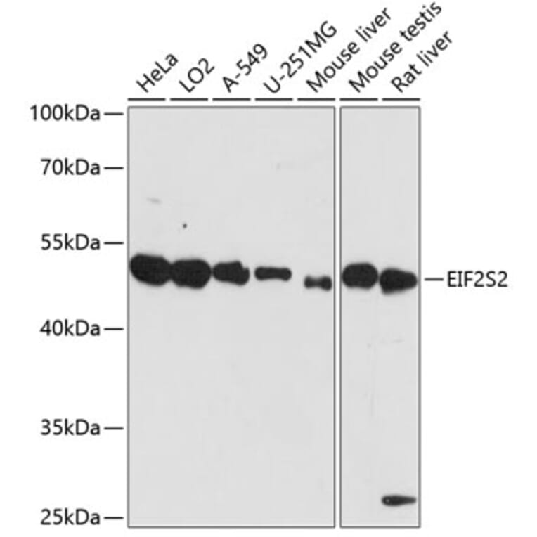 Western Blot - Anti-EIF2S2 / EIF2B Antibody (A90208) - Antibodies.com