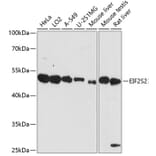 Western Blot - Anti-EIF2S2 / EIF2B Antibody (A90208) - Antibodies.com