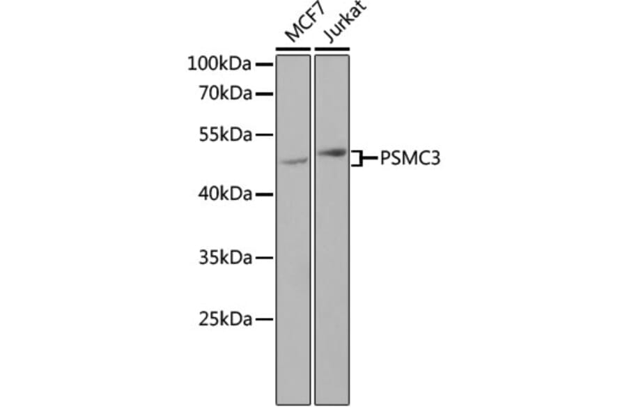 Western Blot - Anti-TBP-1 Antibody (A90209) - Antibodies.com