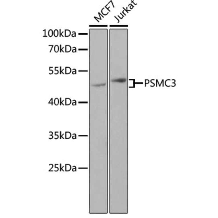 Western Blot - Anti-TBP-1 Antibody (A90209) - Antibodies.com