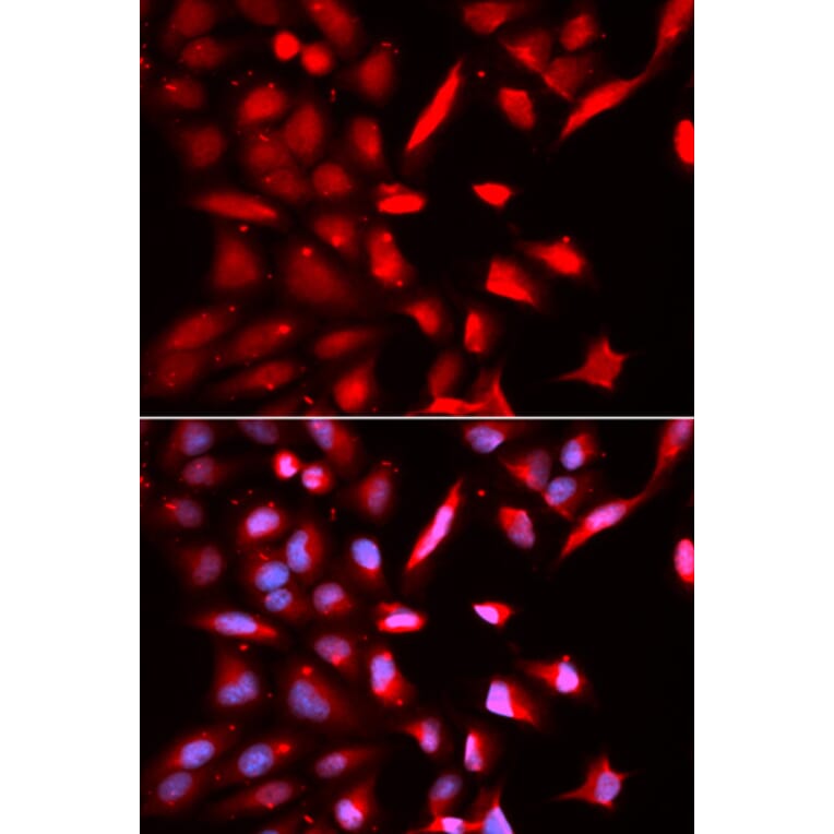 Immunofluorescence - Anti-TBP-1 Antibody (A90209) - Antibodies.com