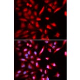 Immunofluorescence - Anti-TBP-1 Antibody (A90209) - Antibodies.com
