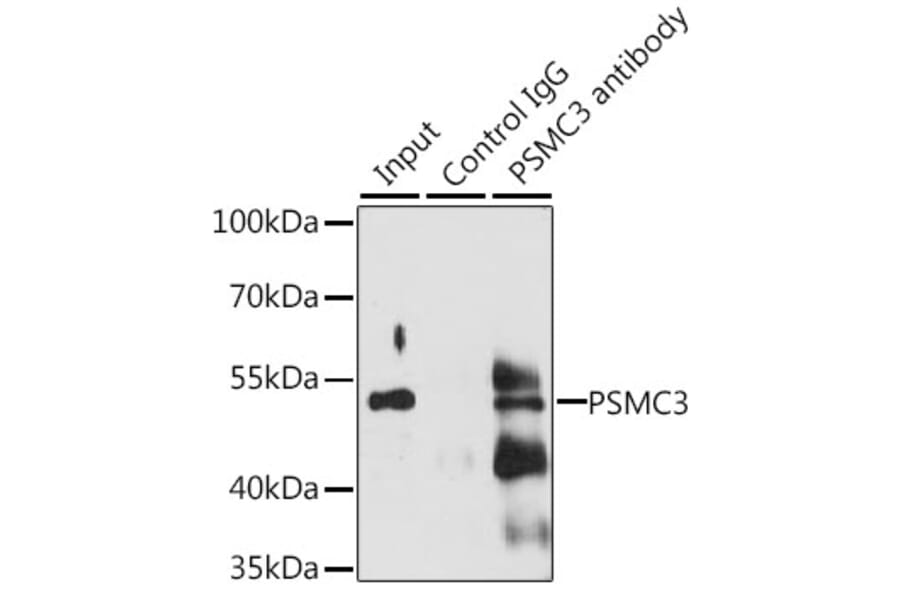 Western Blot - Anti-TBP-1 Antibody (A90209) - Antibodies.com