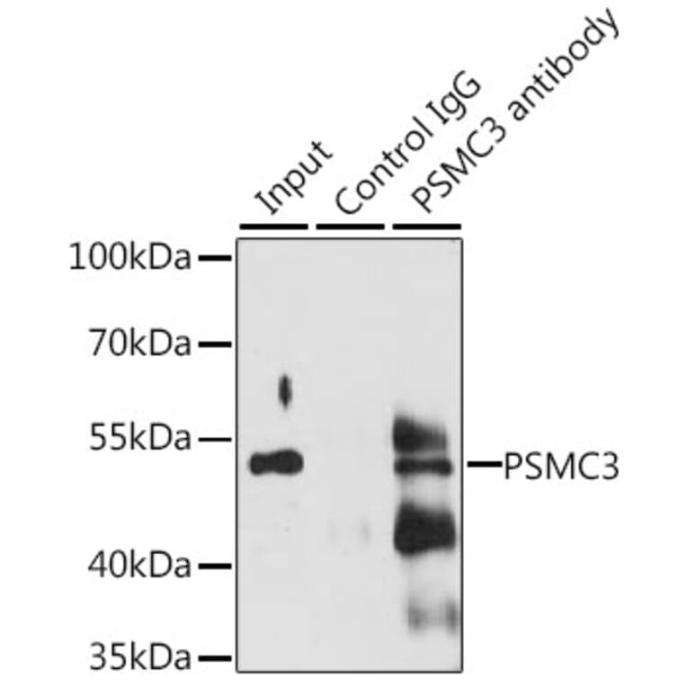 Western Blot - Anti-TBP-1 Antibody (A90209) - Antibodies.com