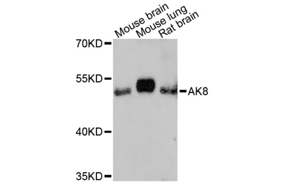 Western Blot - Anti-AK8 Antibody (A13761) - Antibodies.com