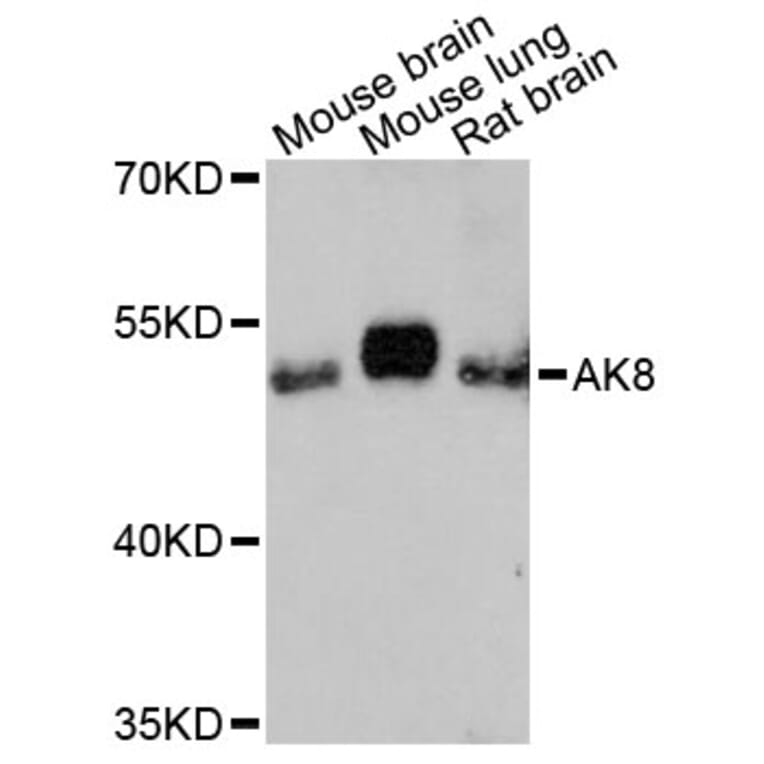 Western Blot - Anti-AK8 Antibody (A13761) - Antibodies.com