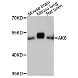 Western Blot - Anti-AK8 Antibody (A13761) - Antibodies.com