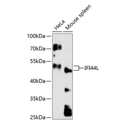 Western Blot - Anti-IFI44L Antibody (A90211) - Antibodies.com