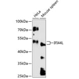 Western Blot - Anti-IFI44L Antibody (A90211) - Antibodies.com