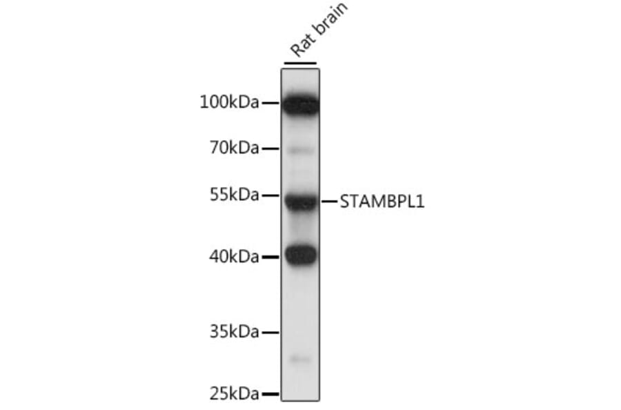 Western Blot - Anti-AMSH-LP Antibody (A90212) - Antibodies.com
