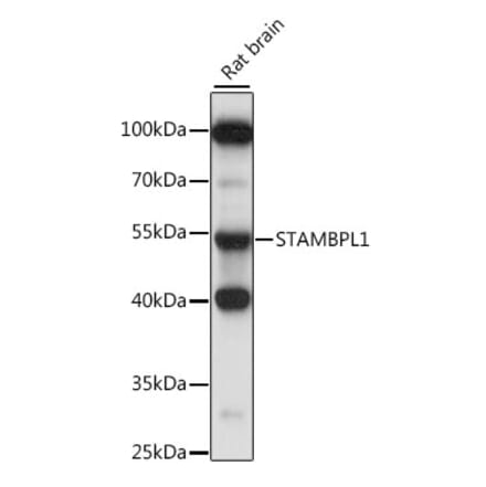 Western Blot - Anti-AMSH-LP Antibody (A90212) - Antibodies.com