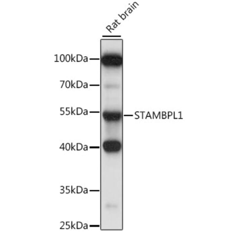 Western Blot - Anti-AMSH-LP Antibody (A90212) - Antibodies.com