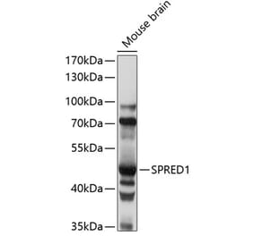 Western Blot - Anti-SPRED1 Antibody (A90213) - Antibodies.com