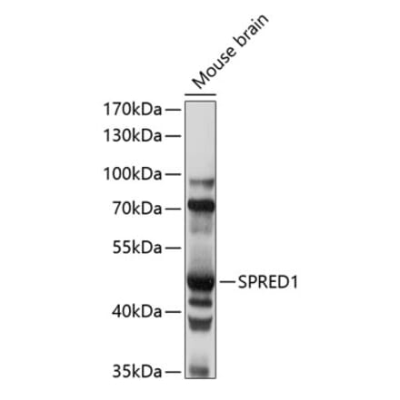 Western Blot - Anti-SPRED1 Antibody (A90213) - Antibodies.com