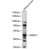 Western Blot - Anti-SPRED1 Antibody (A90213) - Antibodies.com