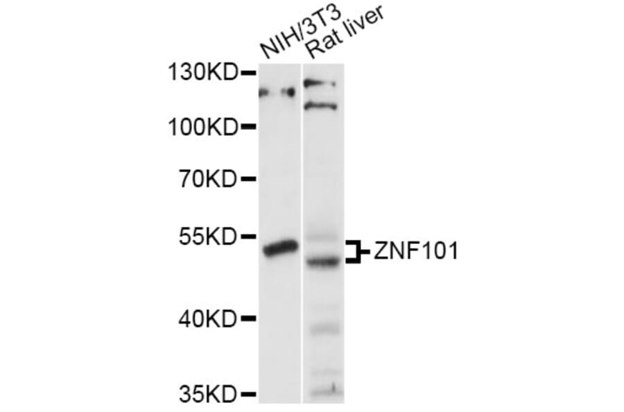 Western Blot - Anti-ZNF101 Antibody (A14356) - Antibodies.com