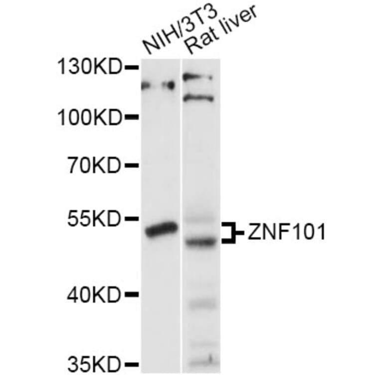 Western Blot - Anti-ZNF101 Antibody (A14356) - Antibodies.com