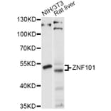 Western Blot - Anti-ZNF101 Antibody (A14356) - Antibodies.com