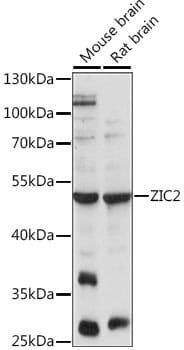 Western blot analysis of extracts of various cell lines, using Anti-ZIC2 Antibody (A15736) at 1:1,000 dilution.
Secondary antibody: Goat Anti-Rabbit IgG (H+L) (HRP) (AS014) at 1:10,000 dilution.
Lysates / proteins: 25µg per lane.
Blocking buffer: 3% non-fat dry milk in TBST.
Detection: ECL Enhanced Kit (RM00021).
Exposure time: 30s.