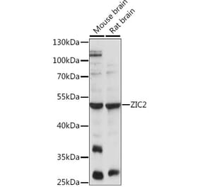 Western Blot - Anti-Zic2 Antibody (A90215) - Antibodies.com