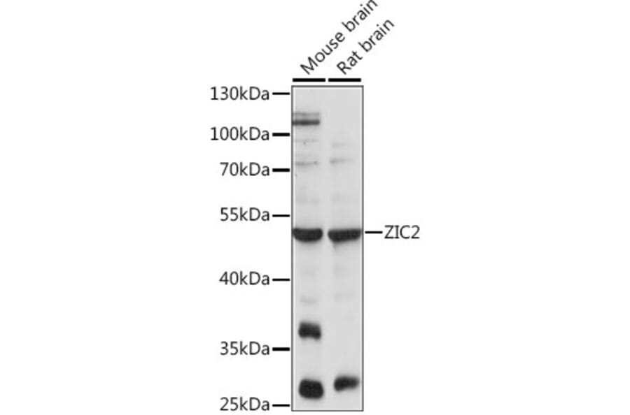 Western Blot - Anti-Zic2 Antibody (A90215) - Antibodies.com