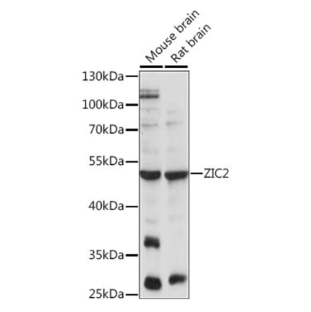 Western Blot - Anti-Zic2 Antibody (A90215) - Antibodies.com