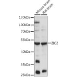 Western Blot - Anti-Zic2 Antibody (A90215) - Antibodies.com