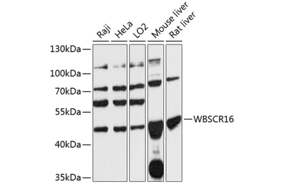 Western Blot - Anti-WBSCR16 Antibody (A90216) - Antibodies.com