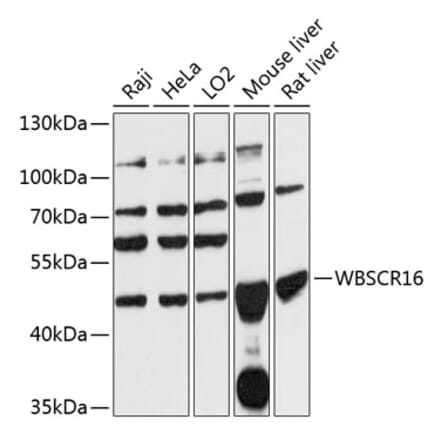 Western Blot - Anti-WBSCR16 Antibody (A90216) - Antibodies.com
