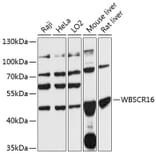 Western Blot - Anti-WBSCR16 Antibody (A90216) - Antibodies.com