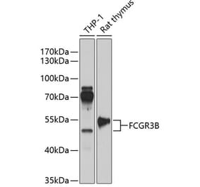 Western Blot - Anti-CD16b Antibody (A90217) - Antibodies.com
