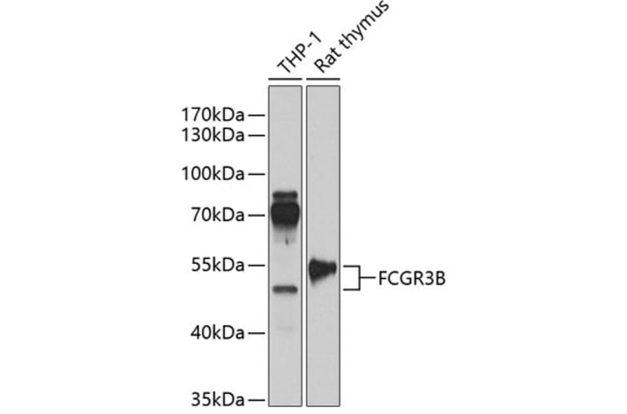 Western Blot - Anti-CD16b Antibody (A90217) - Antibodies.com